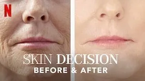 Skin Decision: Before and After 1. Sezon 5. Bölüm (Türkçe Dublaj) izle